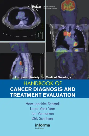 Cover of ESMO Handbook of Cancer Diagnosis and Treatment Evaluation