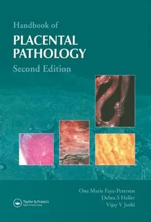 Cover of Handbook of Placental Pathology