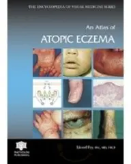 Cover of An Atlas of Atopic Eczema