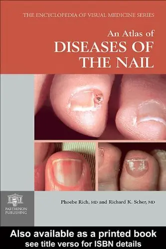 Cover of An Atlas of Diseases of the Nail