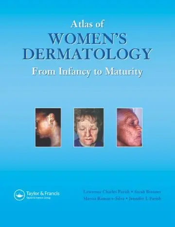 Cover of Atlas of Women's Dermatology