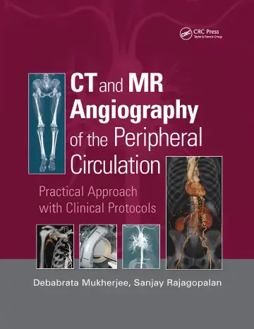 Cover of CT and MR Angiography of the Peripheral Circulation