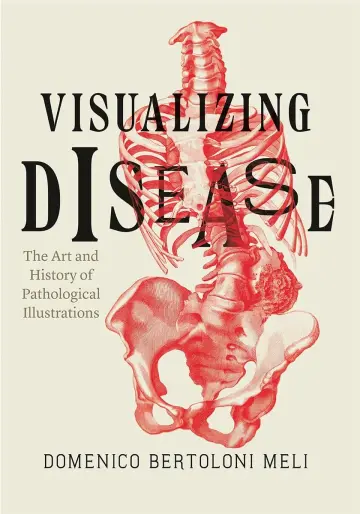 Cover of Visualizing Disease – The Art and History of Pathological Illustrations