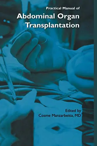 Cover of Practical Manual of Abdominal Organ Transplantation
