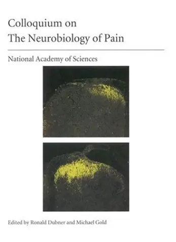 Cover of (NAS Colloquium) the Neurobiology of Pain