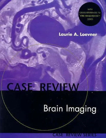 Cover of Brain Imaging