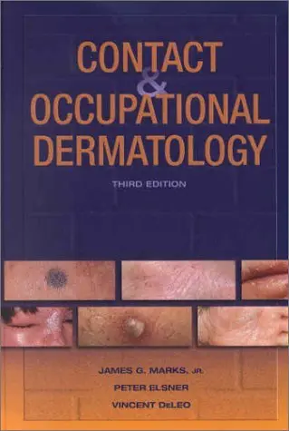 Cover of Contact and Occupational Dermatology
