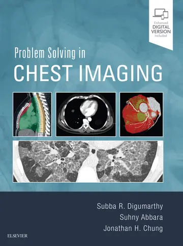 Cover of Problem Solving in Chest Imaging