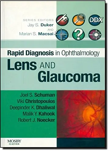 Cover of Lens and Glaucoma