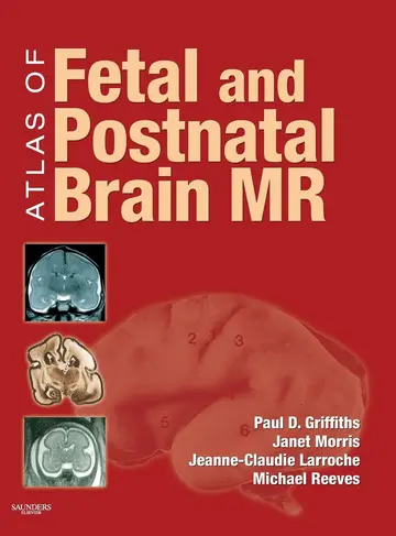 Cover of Atlas of Fetal and Postnatal Brain MR
