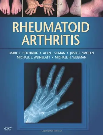 Cover of Rheumatoid Arthritis