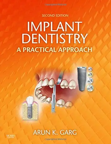 Cover of Implant Dentistry