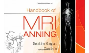 Cover of Handbook of MRI Scanning - 1E