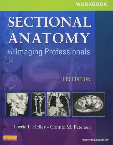 Cover of Workbook for Sectional Anatomy for Imaging Professionals
