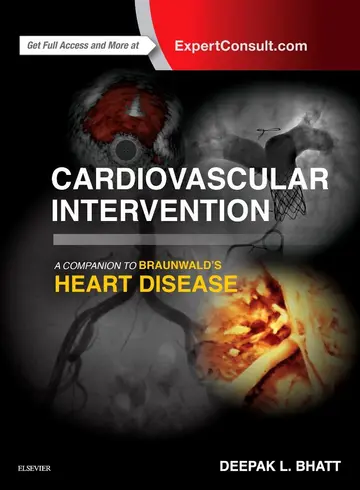 Cover of Cardiovascular Intervention