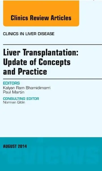 Cover of Liver Transplantation