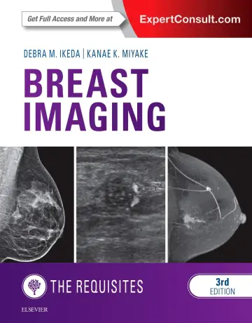 Cover of Old Edition - Breast Imaging