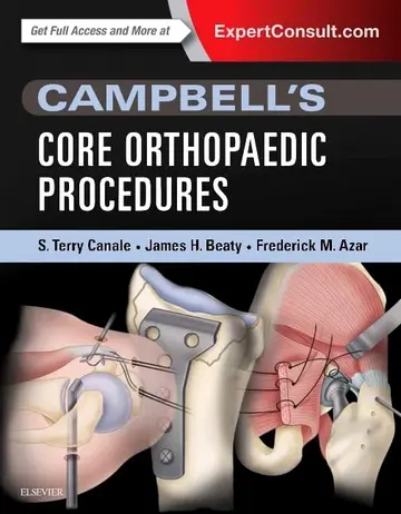 Cover of Campbell's Core Orthopaedic Procedures