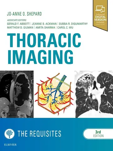 Cover of Thoracic Imaging the Requisites 3Ed