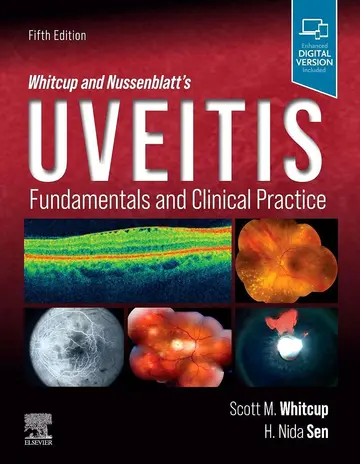 Cover of Whitcup and Nussenblatts Uveitis Fundamentals and Clinical Practice 5Ed