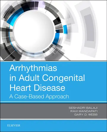 Cover of Arrhythmias in Adult Congenital Heart Disease (Pb 2019)