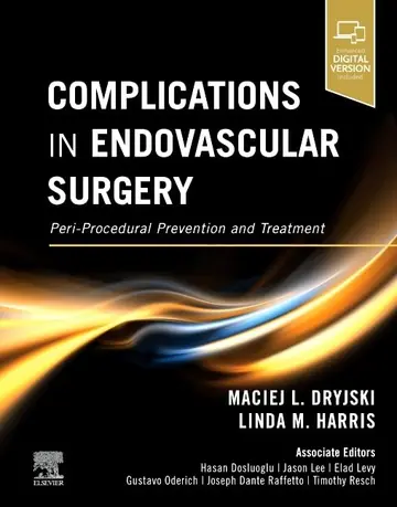 Cover of Complications in Endovascular Surgery