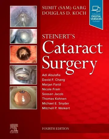 Cover of Steinert's Cataract Surgery