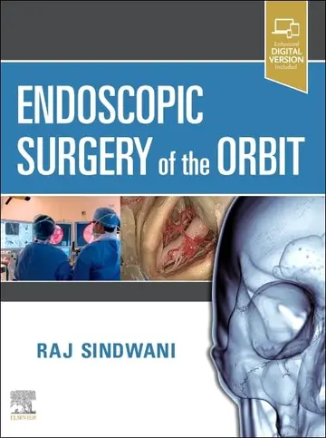 Cover of Endoscopic Surgery of the Orbit