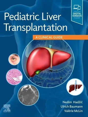 Cover of Pediatric Liver Transplantation