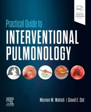 Cover of Practical Guide to Interventional Pulmonology - 1E