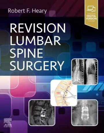 Cover of Revision Lumbar Spine Surgery