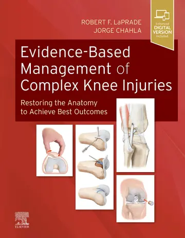 Cover of Evidence-Based Management of Complex Knee Injuries