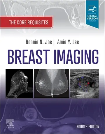 Cover of Breast Imaging-4E