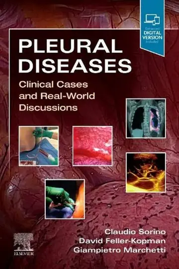 Cover of Pleural Diseases