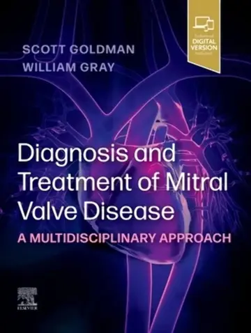 Cover of Diagnosis and Treatment of Mitral Valve Disease