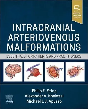 Cover of Intracranial Arteriovenous Malformations