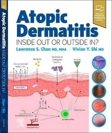 Cover of Atopic Dermatitis