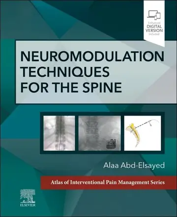 Cover of Neuromodulation Techniques for the Spine