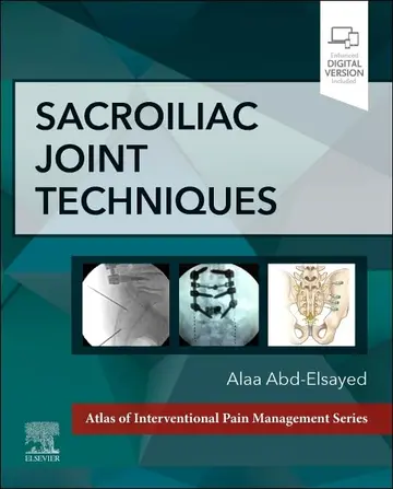 Cover of Sacroiliac Joint Techniques