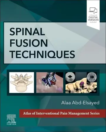 Cover of Spinal Fusion Techniques