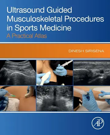 Cover of Ultrasound Guided Musculoskeletal Procedures in Sports Medicine