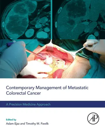 Cover of Contemporary Management of Metastatic Colorectal Cancer