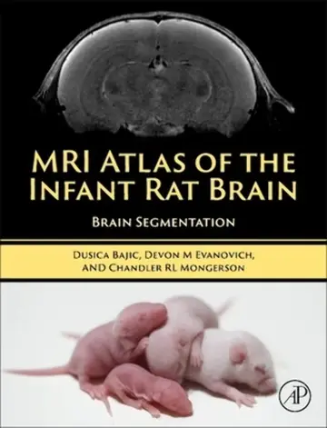 Cover of MRI Atlas of the Infant Rat Brain