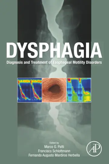 Cover of Dysphagia