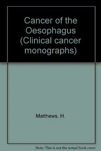 Cover of Cancer of the Oesophagus