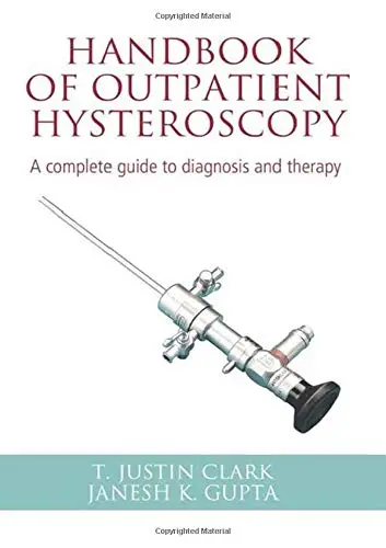Cover of Handbook of Outpatient Hysteroscopy