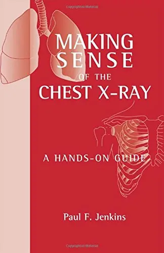 Cover of (Old)Making Sense of the Chest X-Ray