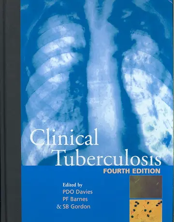 Cover of Clinical Tuberculosis (Old)