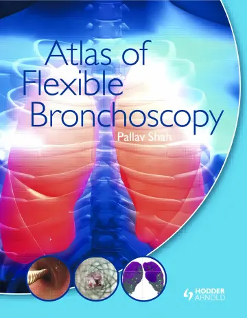 Cover of Atlas of Flexible Bronchoscopy
