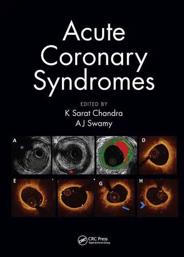Cover of Acute Coronary Syndromes